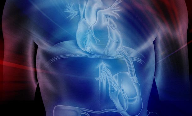 Illustration of an artificial heart inside a man's chest